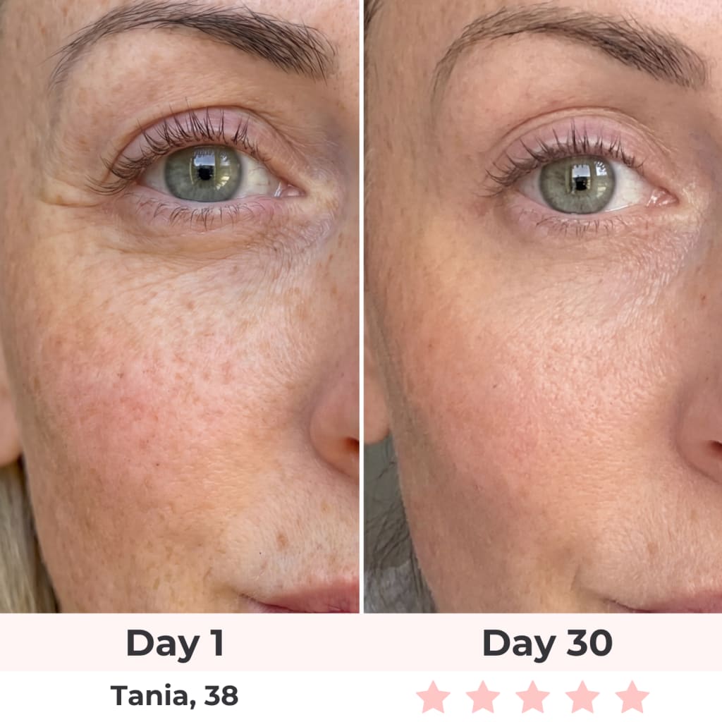 Poter London HaloEyes Red Light & EMS Eye Mask