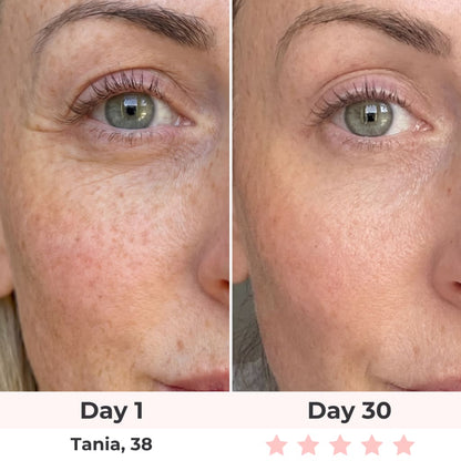 Poter London HaloEyes Red Light & EMS Eye Mask